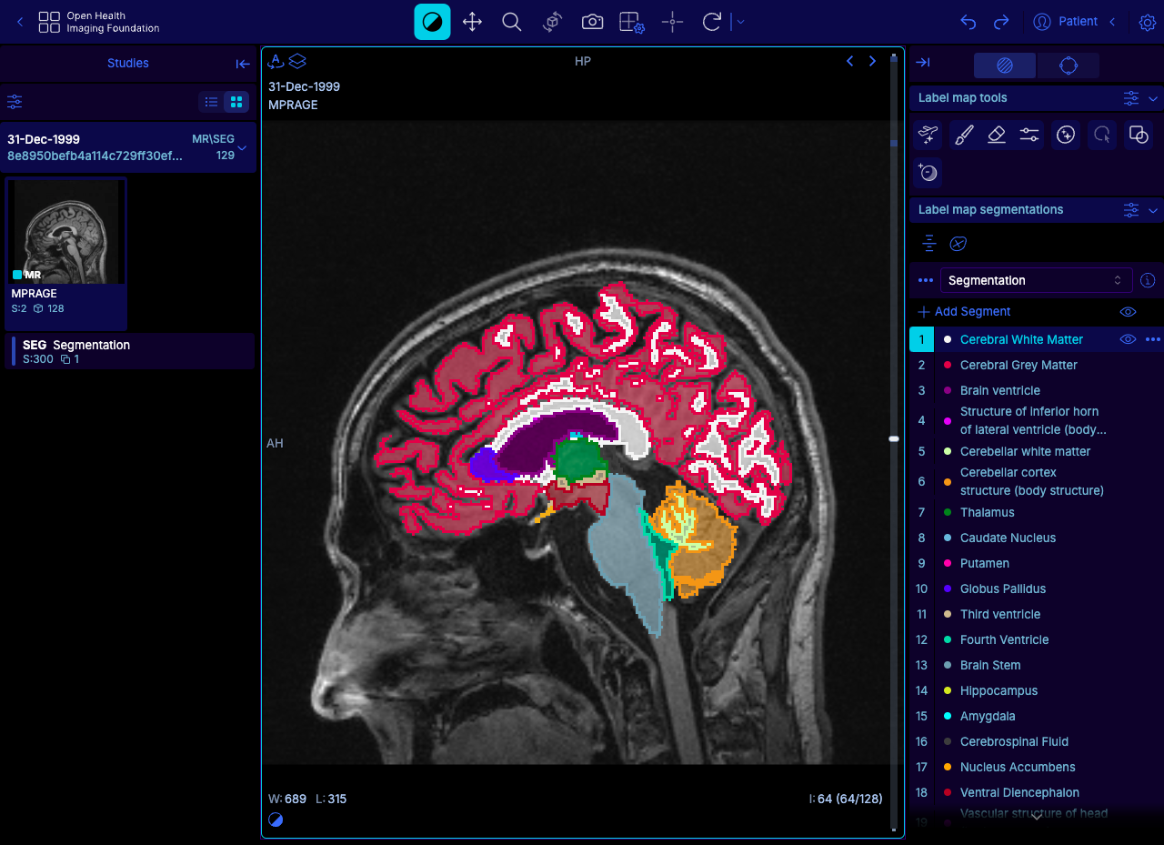 OHIF Viewer