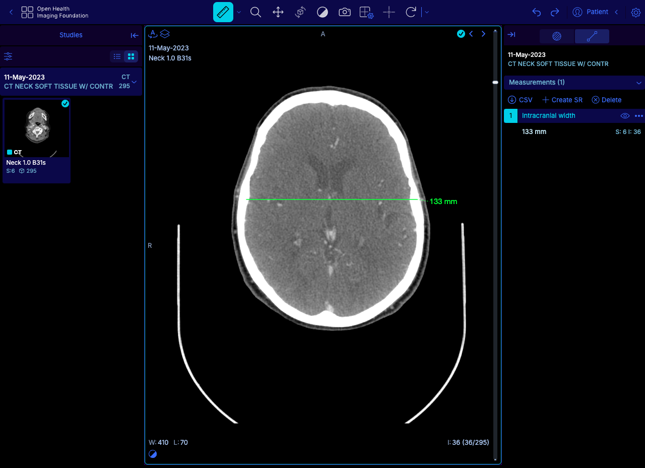 OHIF Viewer