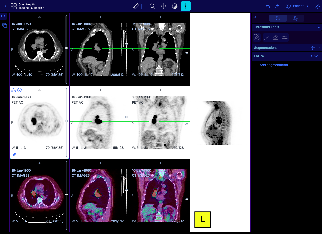 OHIF Viewer